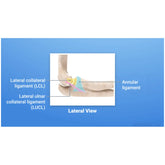 Evaluation and Treatment of Medial Elbow Pathology